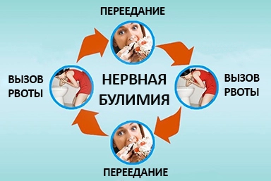 Лечение булимии в Кинель-Черкассах